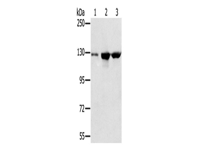 NAT10 Polyclonal Antibody