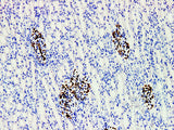 WT1 Monoclonal Antibody Stored at 2~8°C