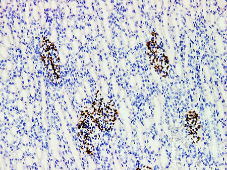 WT1 Monoclonal Antibody Stored at -20°C