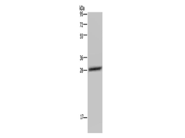 CEBPD Polyclonal Antibody
