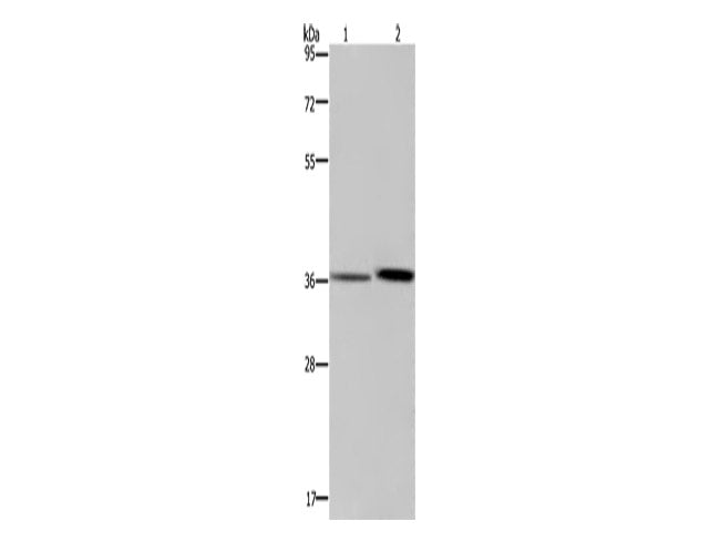 MAGEF1 Polyclonal Antibody