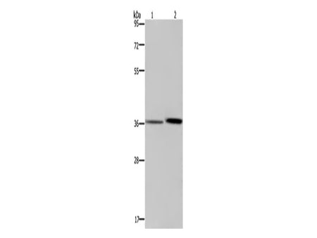 MAGEF1 Polyclonal Antibody