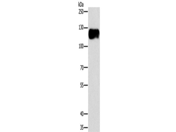 CAST Polyclonal Antibody Store at -20°C