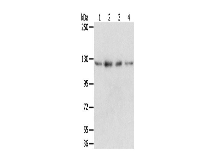 RBM5 Polyclonal Antibody Store at -20°C