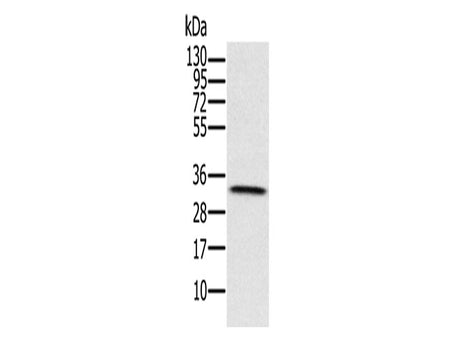 HSD17B8 Polyclonal Antibody Store at -20°C