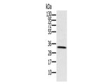 HSD17B8 Polyclonal Antibody Store at -20°C