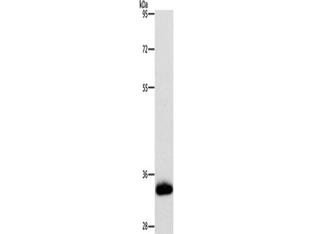 AMBP Polyclonal Antibody Store at -20°C