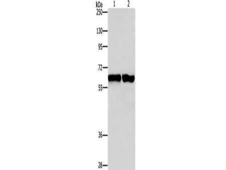 ASNS Polyclonal Antibody Store at -20°C