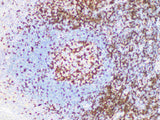 ZAP-70 Monoclonal Antibody Stored at 2~8°C