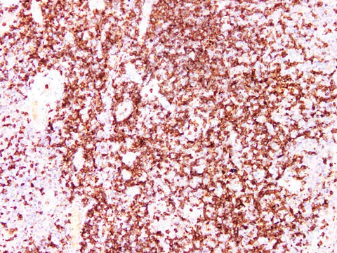 ZAP-70 Monoclonal Antibody Stored at -20°C