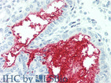 SLC34A2 Polyclonal Antibody Store at -20°C