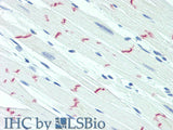 DSG2 Polyclonal Antibody Store at -20°C